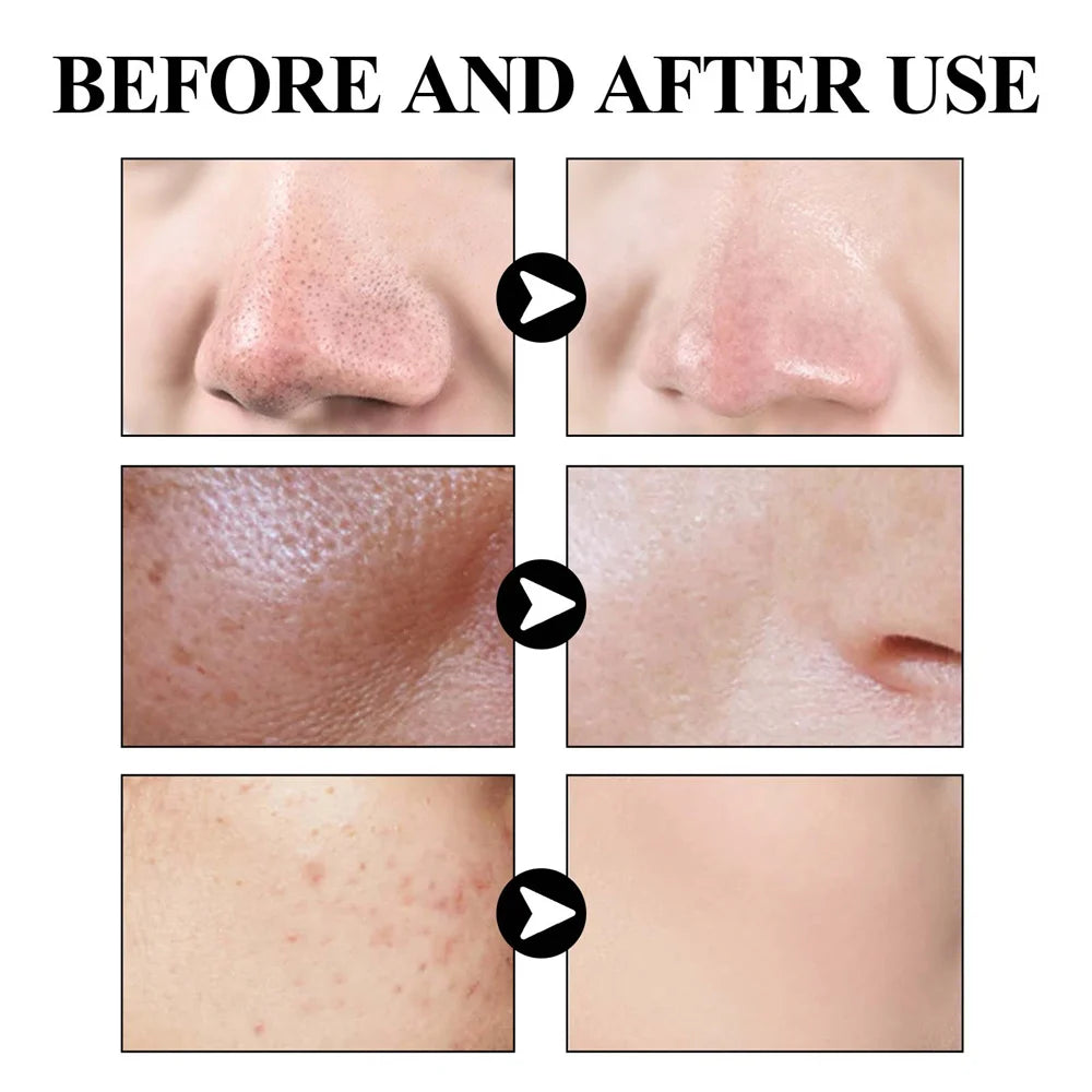 Blackhead Removing Mud Face Mask Oil Control Skincare