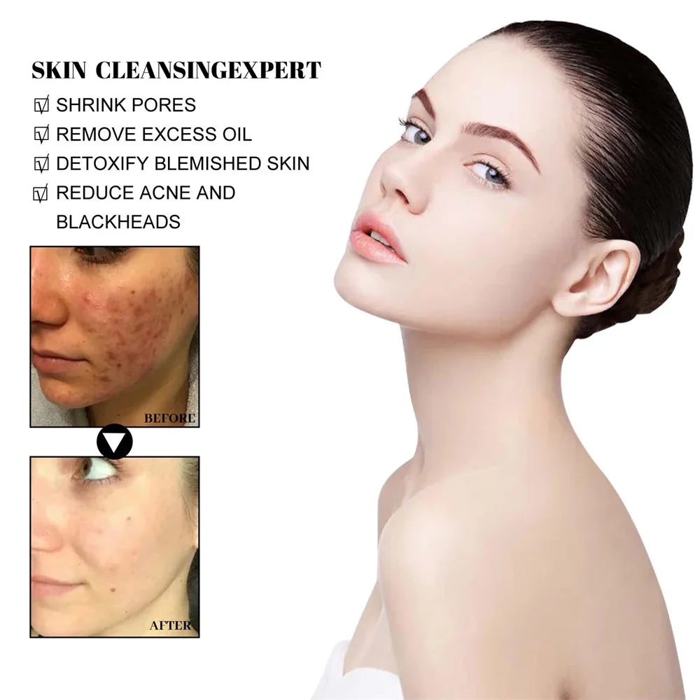 Blackhead Removing Mud Face Mask Oil Control Skincare