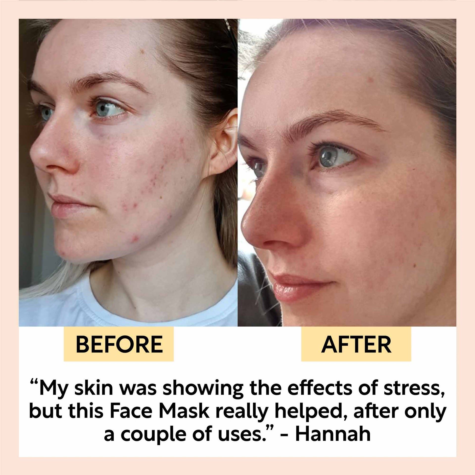 Clay Face Mask for Deep Skin Cleansing