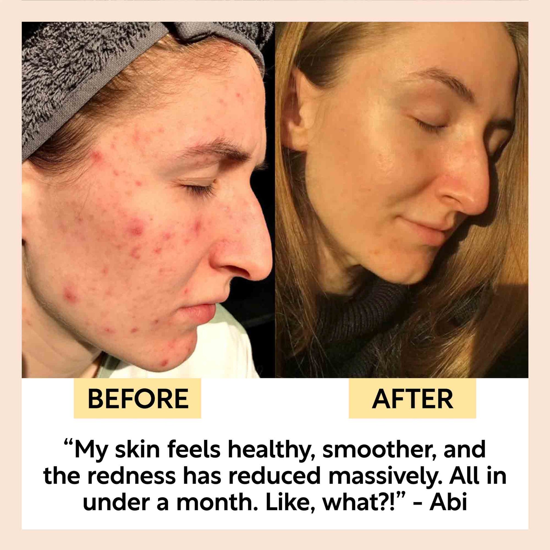 Clay Face Mask for Deep Skin Cleansing