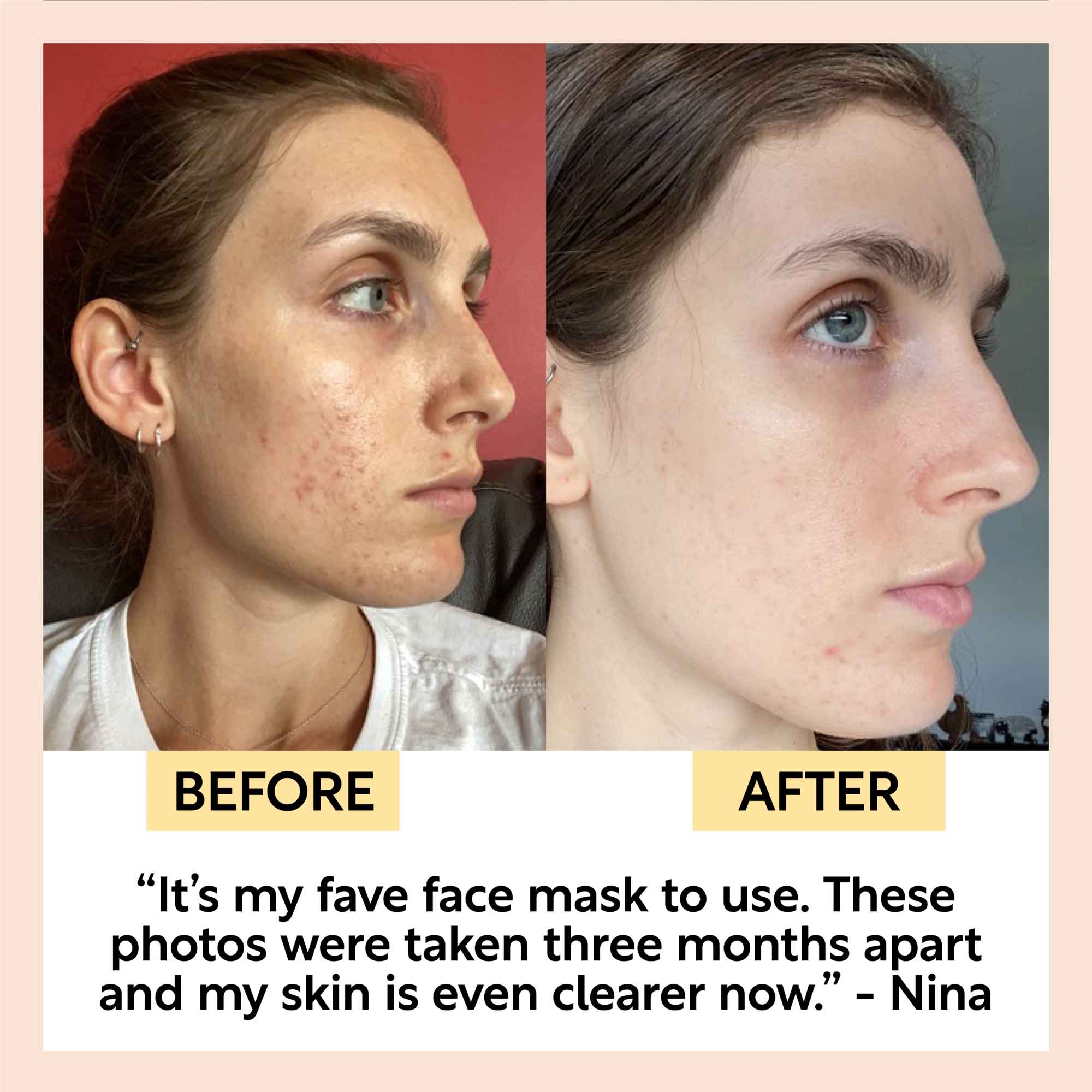 Clay Face Mask for Deep Skin Cleansing